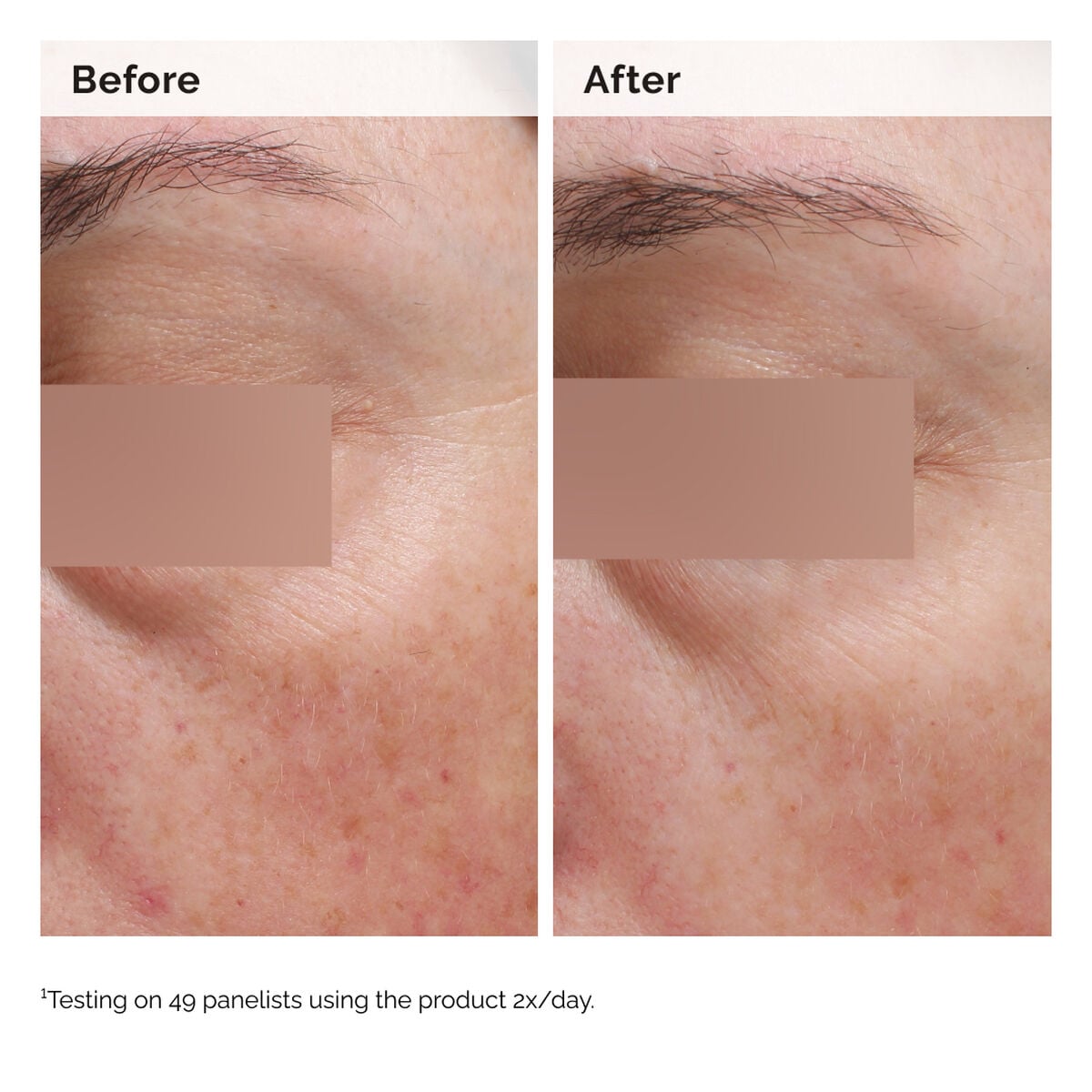 niacinamide-5-face-and-body-emulsion-e3 2024-08-23-ORD-Nia-5pct-Face-Body-B-A-Elasticity-Global-02-1x1.jpg