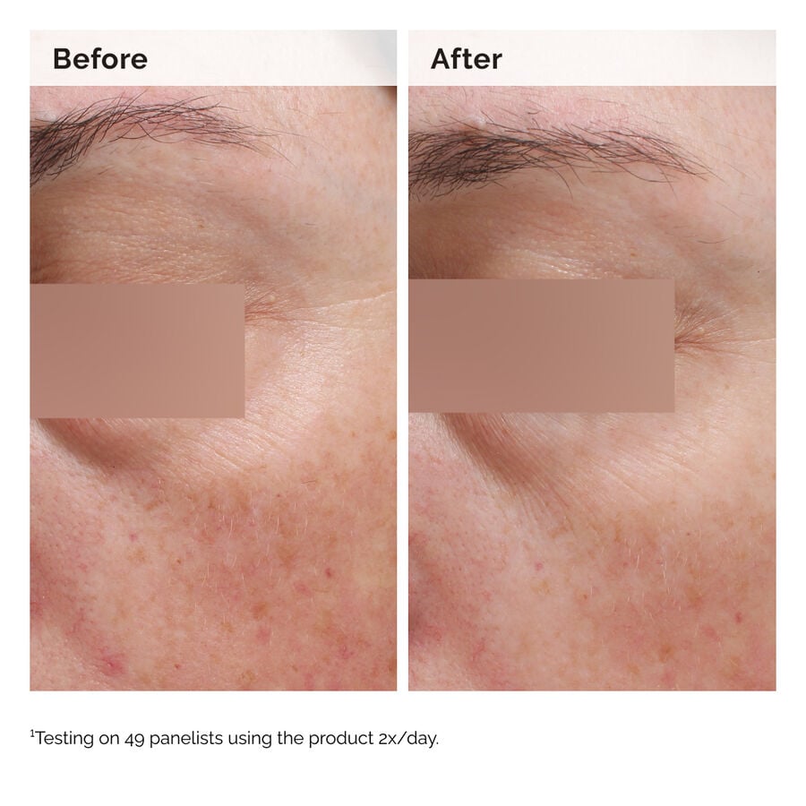 niacinamide-5-face-and-body-emulsion-e3 2024-08-23-ORD-Nia-5pct-Face-Body-B-A-Elasticity-Global-02-1x1.jpg