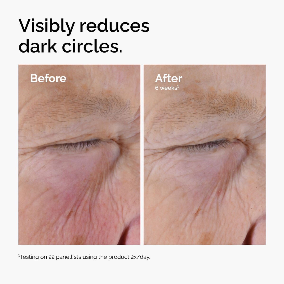 caffeine-solution-5-egcg-eye-serum-i2 ord-caffeine-solution-egcg-dark-circles-before-after.jpg