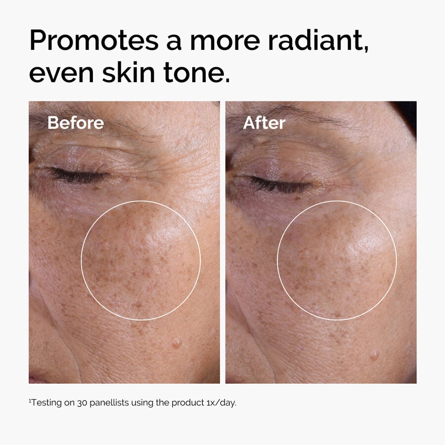 glycolic-acid-7-exfoliating-toner-y5 ord-glycolic-before-after-radiance.jpg