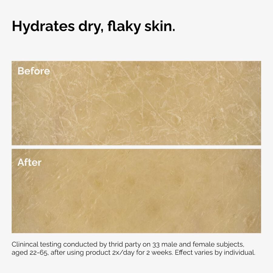 the-body-care-collection-u7 ord-natural-moisturizing-factors-inulin-body-before-after-graphic-02.jpg