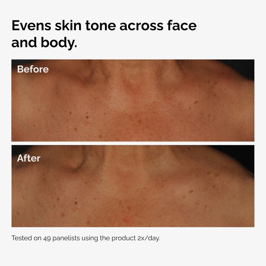 the-body-care-collection-u7 ord-niacinamide-face-body-serum-before-after-even-tone-graphic.jpg