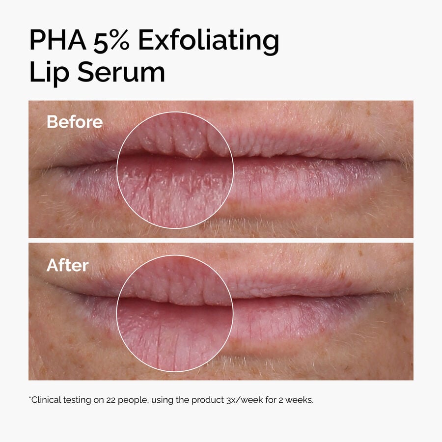 pha-5-exfoliating-lip-serum-u8 ord-pha-5pct-lip-exfoliating-serum-before-after.jpg
